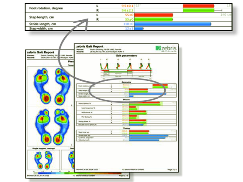 Gait analysis